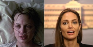 Angelina Jolie ασθενής από την ταινία Gia και σε μια ομιλία για την υγεία της.