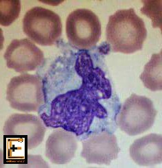 λευκά κουνελοσφαιρια στο μικροσκοπιο. Ειδικευομένων eidikeuomenoi