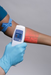 μηχάνημα που βλέπει φλέβες