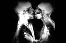 δύο άτομα φιλιούνται μέσα σε μαγνητικό τομογράφο. Ειδικευόμενοι eidikeyomenoi eidikeuomenoi