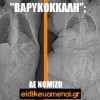 Βαρυκόκκαλη;