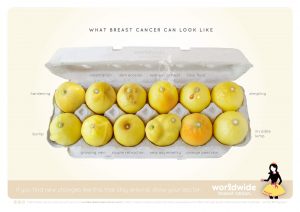 Know your lemons λεμόνια σαν μαστοί, τύποι του καρκίνου του μαστού