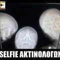 Selfie ακτινολόγων. Ακτινογραφία με τρια κρανία